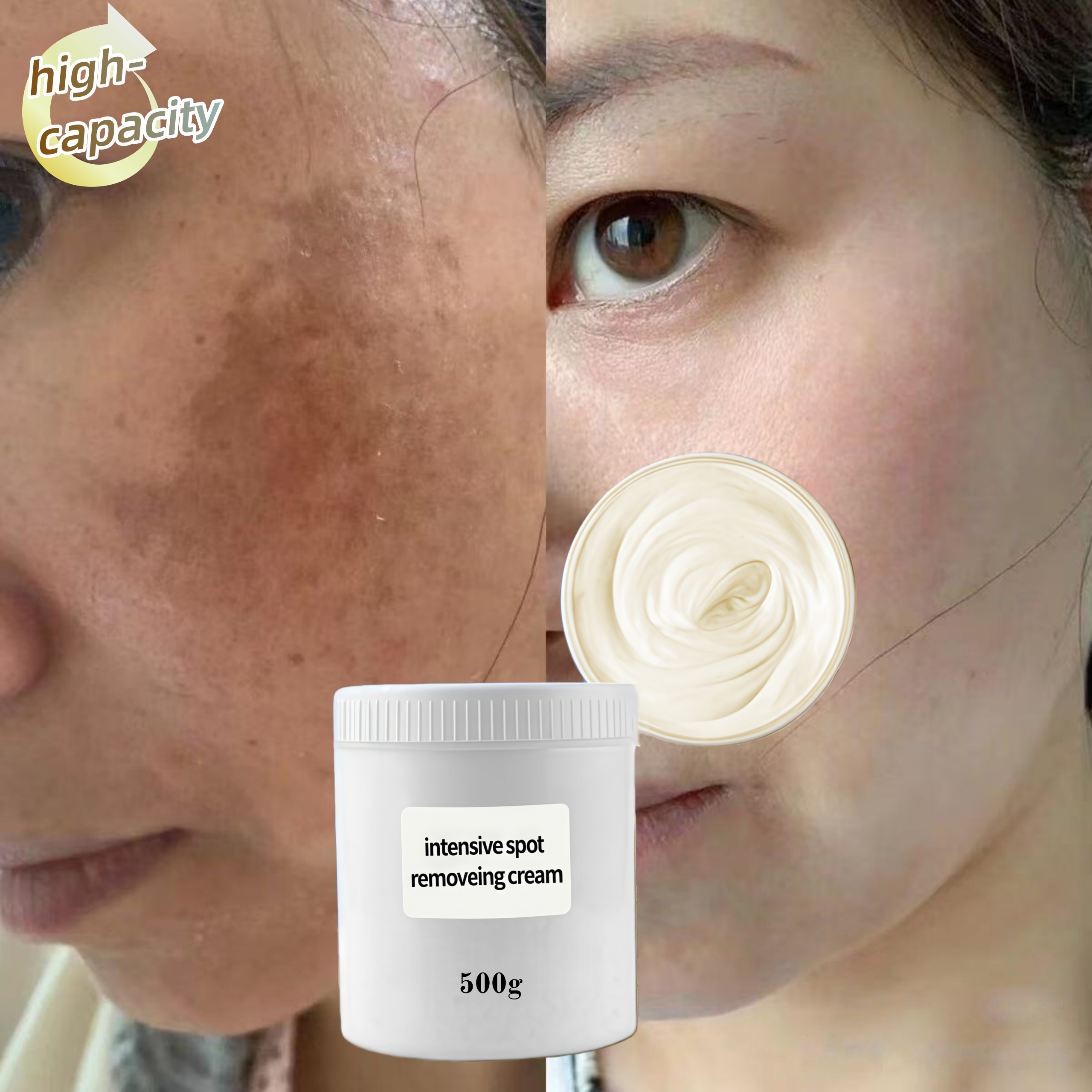 Intensive Anti Dark Spots Corrector Freckles Skin Whitening Creme Melasma Spot Pigmentation Peel Removal Treatment Face Cream kg